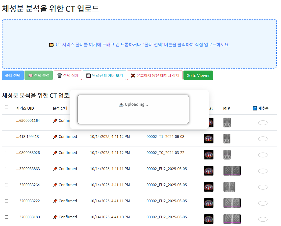 CT 영상 업로드